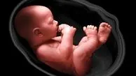 تصمیم «شوکه کننده» وزارت بهداشت/ غربالگری جنین غیرممکن شد؟

