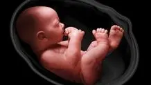 تصمیم «شوکه کننده» وزارت بهداشت/ غربالگری جنین غیرممکن شد؟

