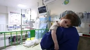 چالش در درمان رایگان کودکان زیر ۷ سال