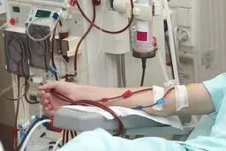 بیماران خاص و صعب العلاج هزینه‌ای در بیمارستان پرداخت نمی‌کنند

