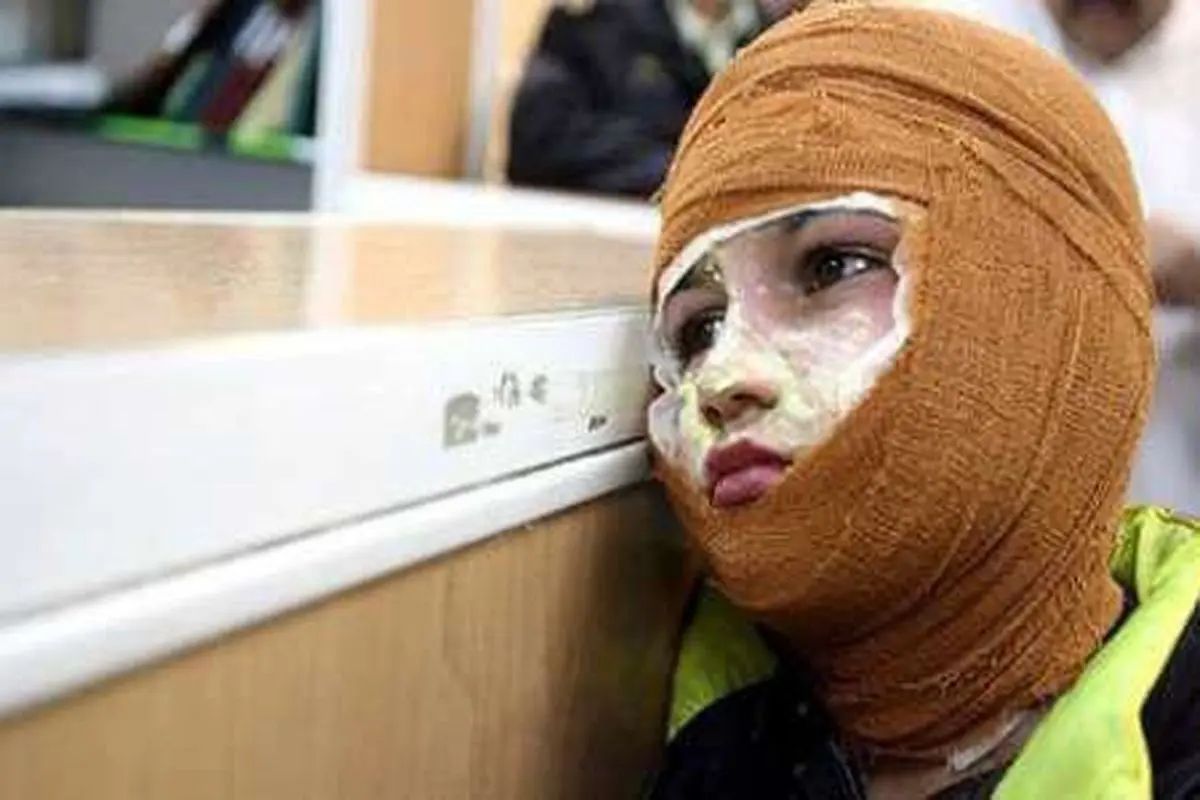 آمار بالای «سوختگی» در کشور
