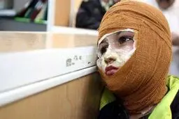 آمار بالای «سوختگی» در کشور
