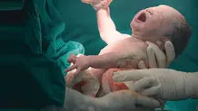 چرا هدف قانون جوانی جمعیت در افزایش زایمان طبیعی هنوز محقق نشده است؟
