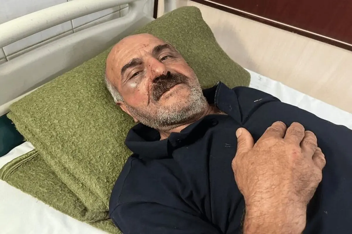 حمله قاچاقچیان چوب به جنگلبان چالوسی