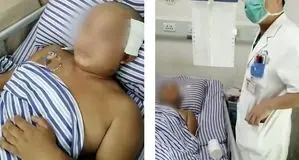 کرم ۱۸ سانتی متری زنده در مغز مرد چینی!+ عکس