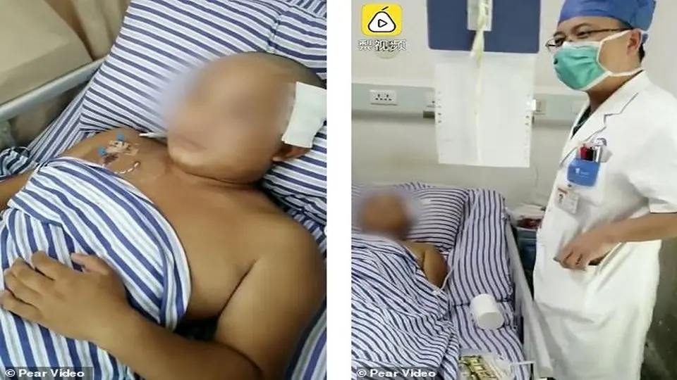 کرم ۱۸ سانتی متری زنده در مغز مرد چینی!+ عکس