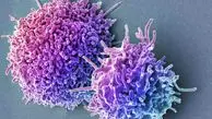 بالا بودن lymphocyte در آزمایش خون نشانه چیست؟