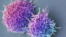 بالا بودن lymphocyte در آزمایش خون نشانه چیست؟