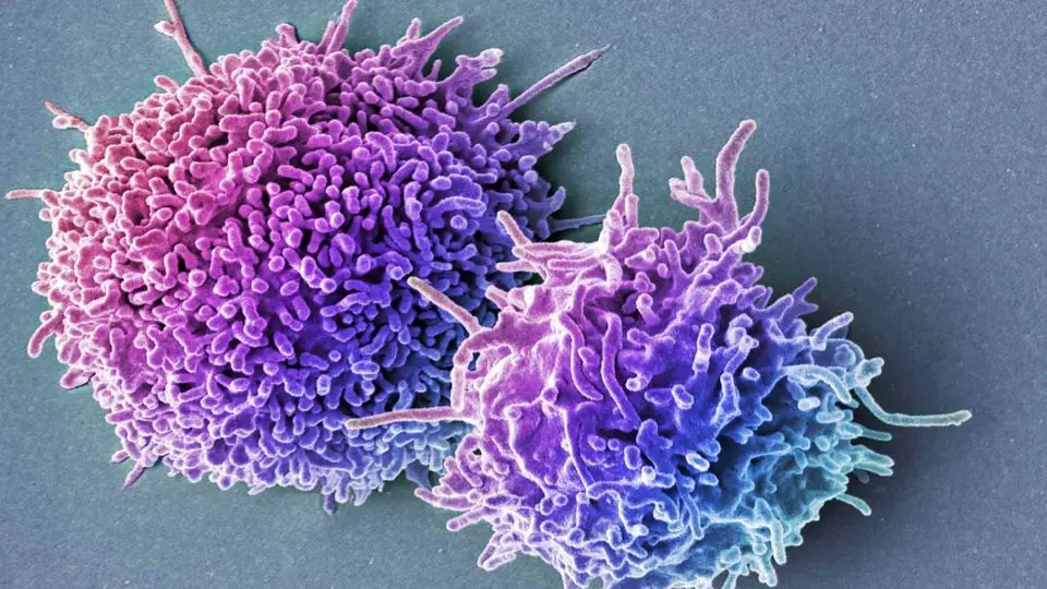 بالا بودن lymphocyte در آزمایش خون نشانه چیست؟