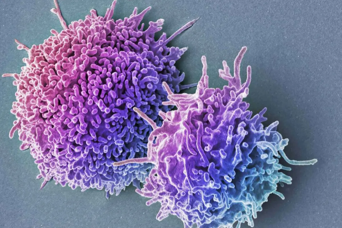 بالا بودن lymphocyte در آزمایش خون نشانه چیست؟