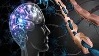 هوش مصنوعی، چشم جدید پزشکان برای پیگیری ام‌اس
