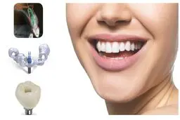 آیا ایمپلنت باعث سرطان می شود؟