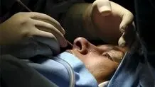 سن جراحی زیبایی در ایران به 14 سال رسیده است