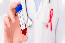 ثبت ۲۳ هزار فرد مبتلا به HIV در کشور