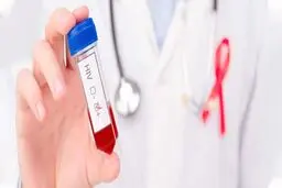 ثبت ۲۳ هزار فرد مبتلا به HIV در کشور
