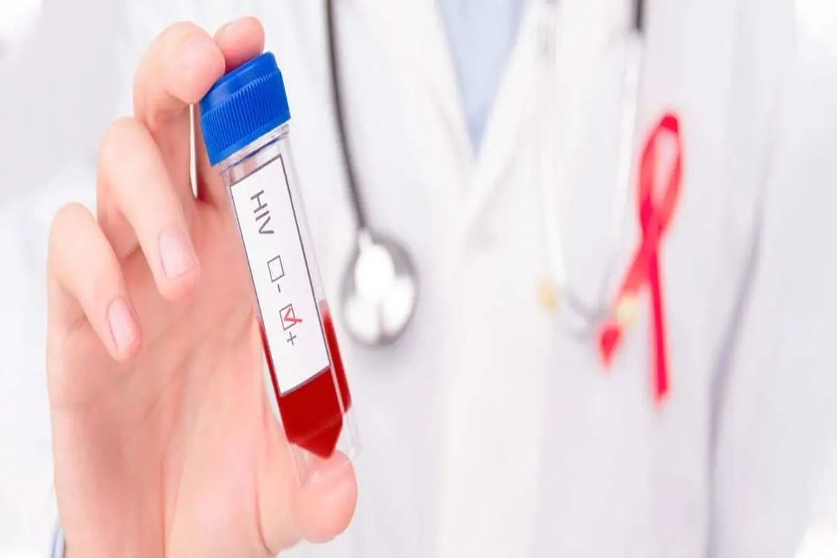 ثبت ۲۳ هزار فرد مبتلا به HIV در کشور