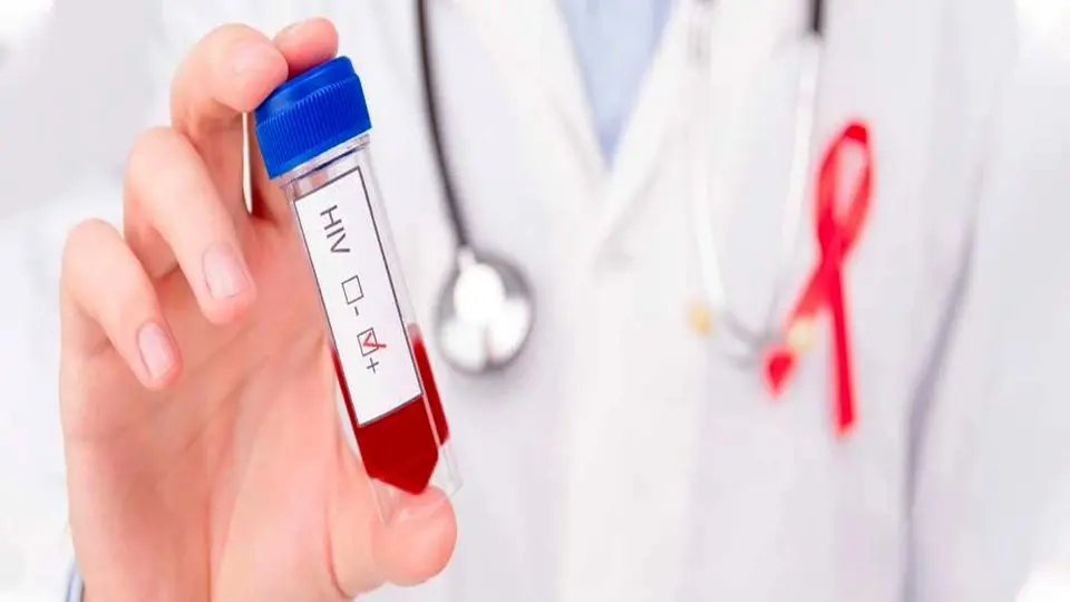 ثبت ۲۳ هزار فرد مبتلا به HIV در کشور