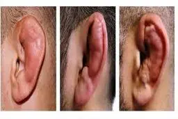 اجازه بده گوش‌هایت را بشکنیم    