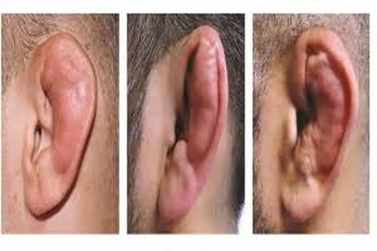 اجازه بده گوش‌هایت را بشکنیم    