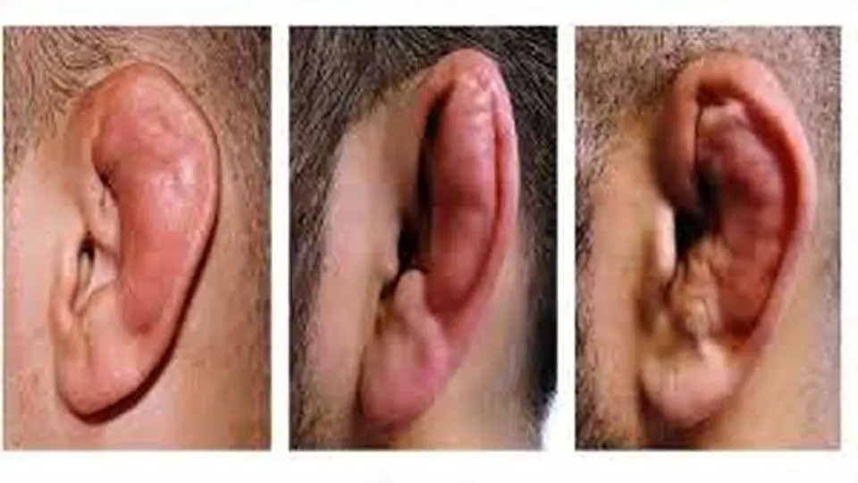 اجازه بده گوشهایت را بشکنیم