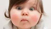 روش های ساده تپل شدن و چاقی صورت در کم ترین زمان
