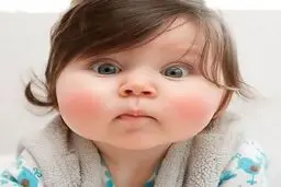 روش های ساده تپل شدن و چاقی صورت در کم ترین زمان
