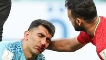 بیرانوند در ترکیب نهایی ایران در برابر ولز قرار دارد؟