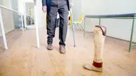 خانه‌نشینی معلولان با گرانی پروتزها
