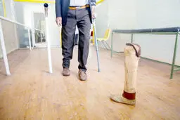 خانه‌نشینی معلولان با گرانی پروتزها
