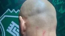 تصویری از جراحت مربی دروازه بانان استقلال بعد از بازی با خیبر