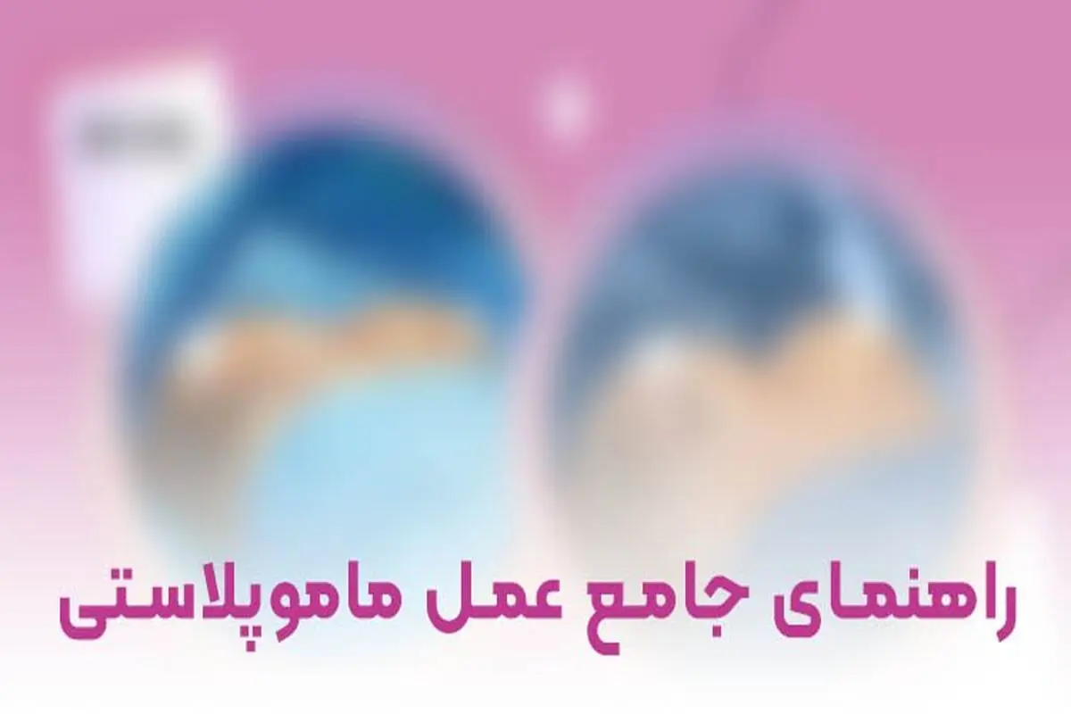 0 تا 100 عمل ماموپلاستی را در این مقاله بخوانید

