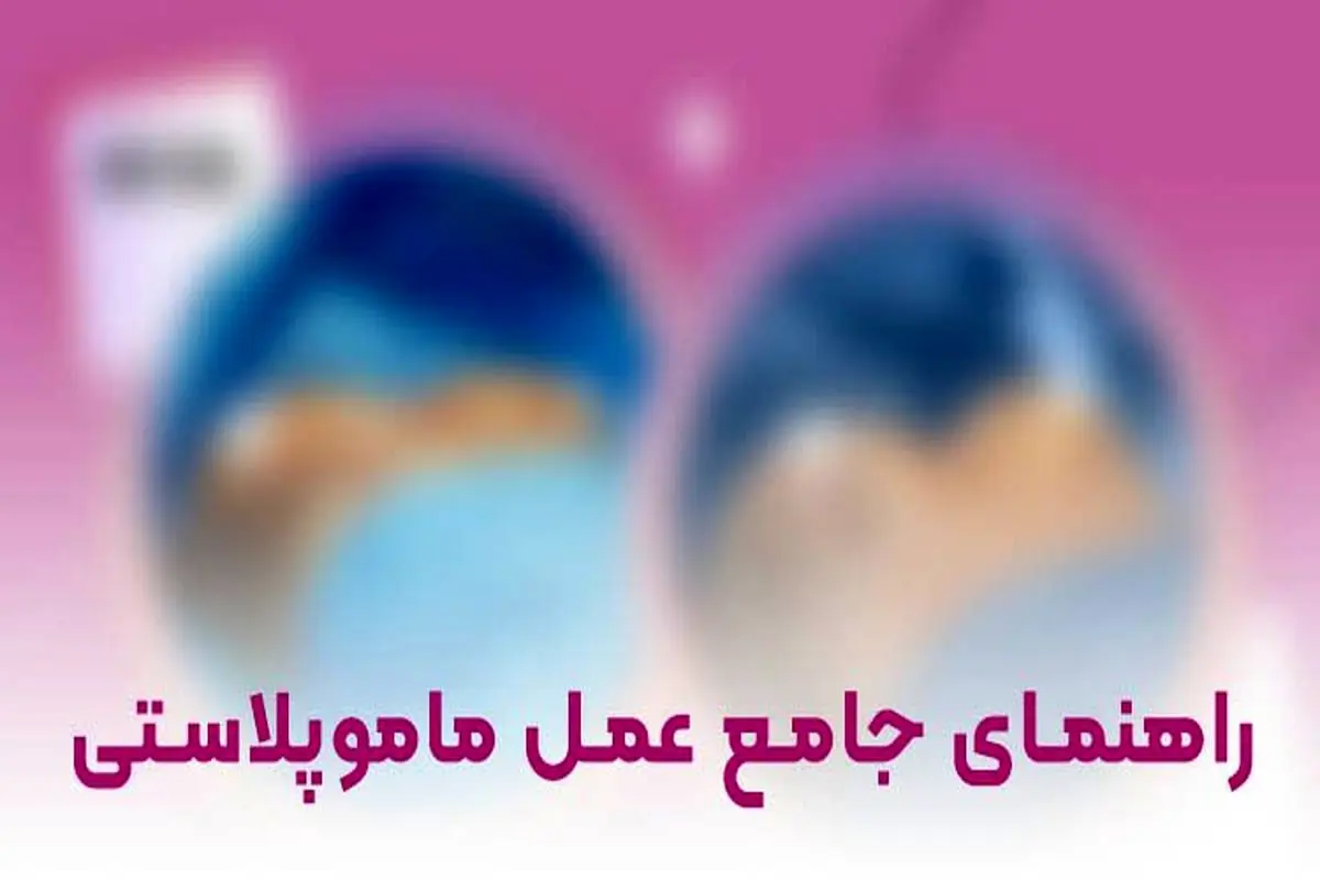 0 تا 100 عمل ماموپلاستی را در این مقاله بخوانید

