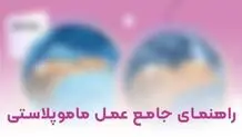 0 تا 100 عمل ماموپلاستی را در این مقاله بخوانید

