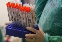 شناسایی ۸۸۳۱ بیمار جدید مبتلا به کرونا و مرگ 34 نفر + جدول