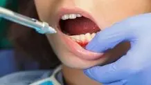 بیماران مبتلا به ایدز چطور از خدمات دندان‌پزشکی استفاده کنند؟