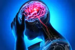 اصلاح تصورات عمومی درباره  سکته مغزی