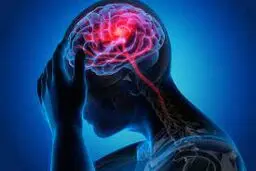 اصلاح تصورات عمومی درباره  سکته مغزی
