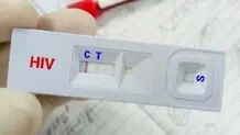 ویروس HIV قابل کنترل است به شرط درمان

