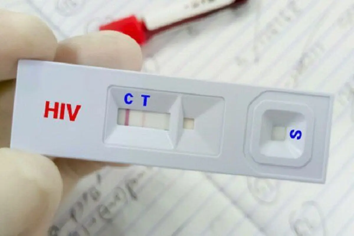 ویروس HIV قابل کنترل است به شرط درمان

