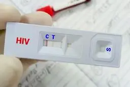 ویروس HIV قابل کنترل است به شرط درمان

