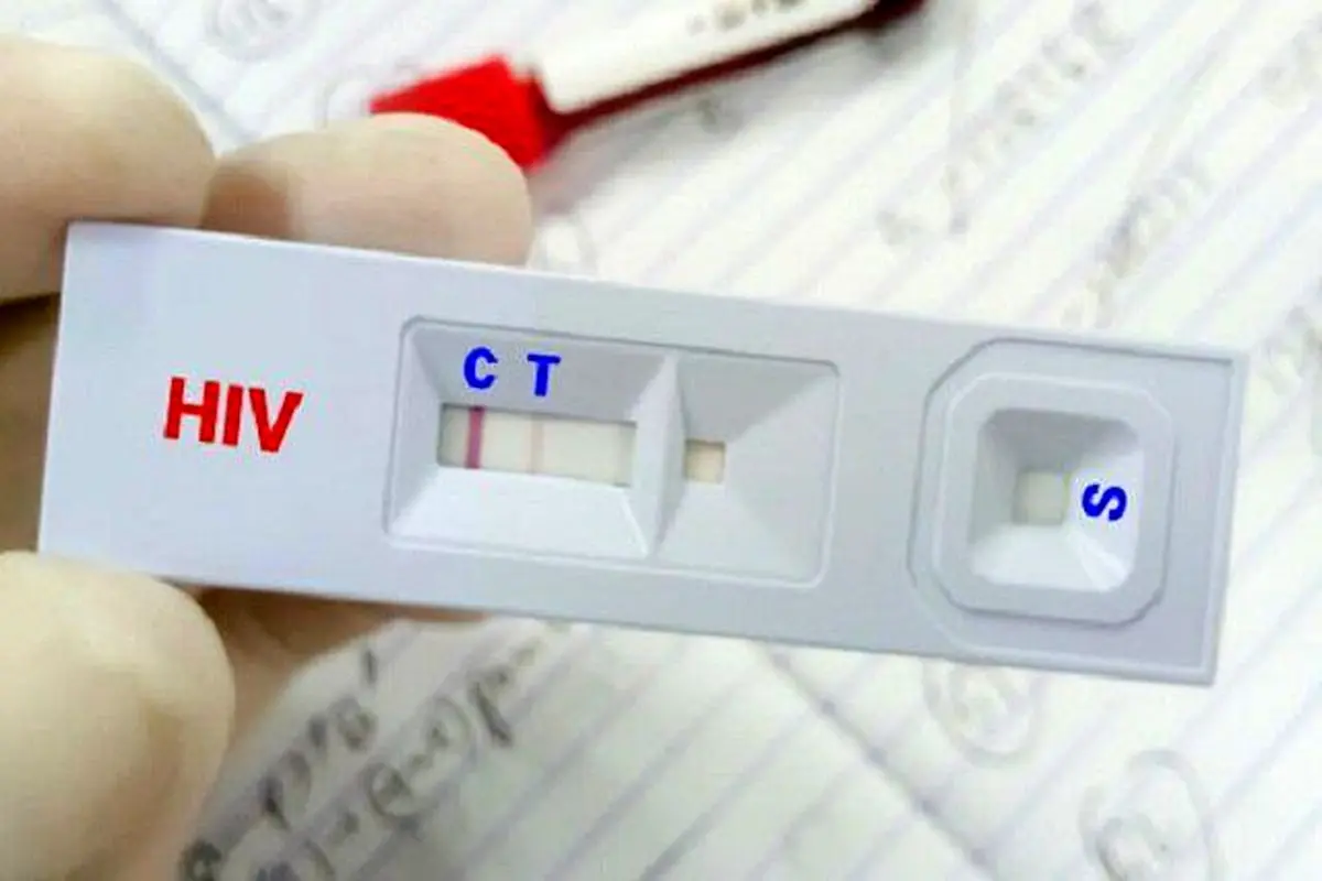 ویروس HIV قابل کنترل است به شرط درمان

