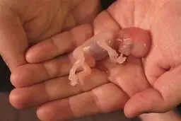 این گزارش  تنَش درد می‌کند