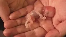  این گزارش  تنَش درد می‌کند