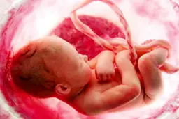تفاوت جنسیتی، حتی در دیه‌ جنین
