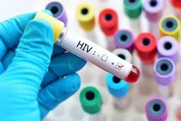 درمان رایگان و محرمانه HIV در کشور/ ضرورت گسترش تست‌های خودآزمایی

