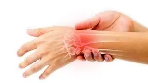 پوکی استخوان در نیمی از زنان بالای ۵۰ سال