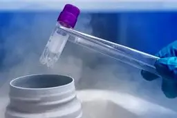 اجازه پدر برای فریز تخمک پایه قانونی ندارد