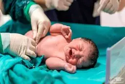 در این تاریخ سزارین ممنوع شد 