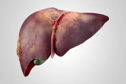 ۳ عامل مهم خطرناک برای کبد