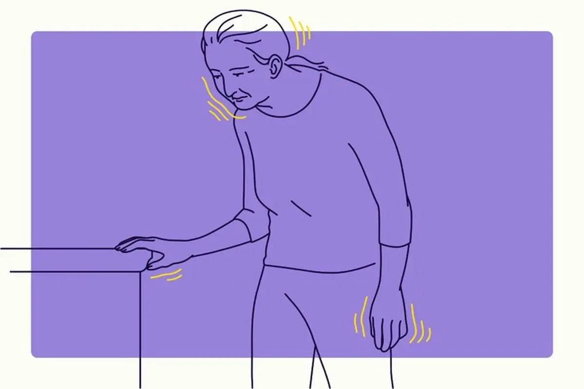 نحوه تشخیص پارکینسون با هوش مصنوعی